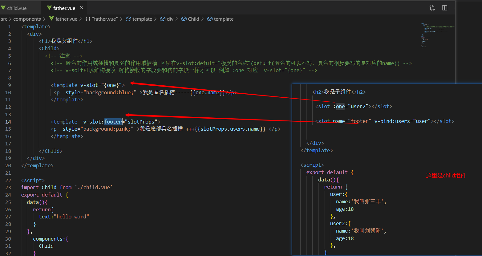 Vue中插槽slot的使用方法与应用场景详析